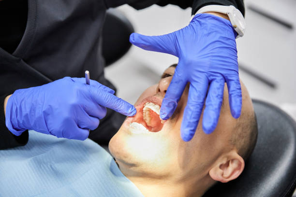 Best Broken or Chipped Tooth Repair in Fort Washakie, WY