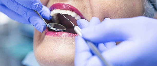 Best Emergency Treatment for Oral Infections in Fort Washakie, WY